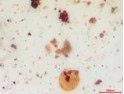 Resins